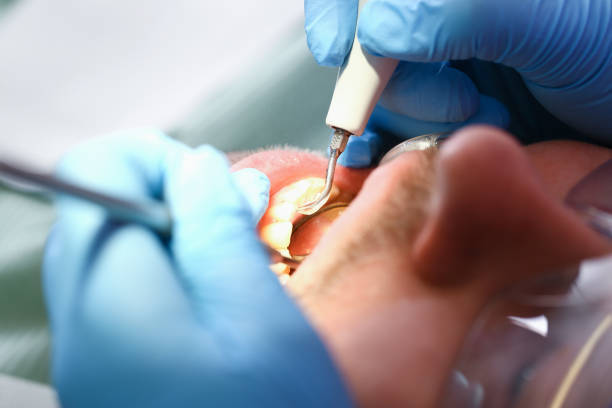Best Cracked Tooth Emergency Dentist  in Orfordville, WI