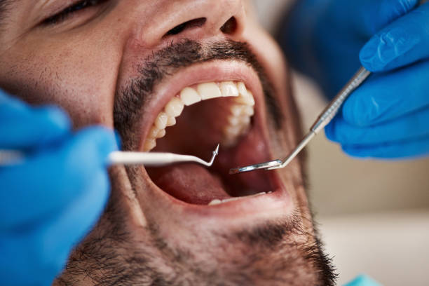 Best Teeth Whitening  in Orfordville, WI